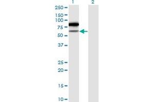 Western Blot analysis of TRMT2A expression in transfected 293T cell line by TRMT2A monoclonal antibody (M02), clone 4C10-1A11. (TRMT2A 抗体  (AA 1-625))