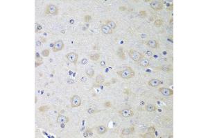 Immunohistochemistry of paraffin-embedded mouse brain using YES1 antibody (ABIN5974700) at dilution of 1/100 (40x lens). (YES1 抗体)