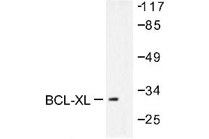 Image no. 1 for anti-BCL2-Like 1 (BCL2L1) antibody (ABIN265327) (BCL2L1 抗体)