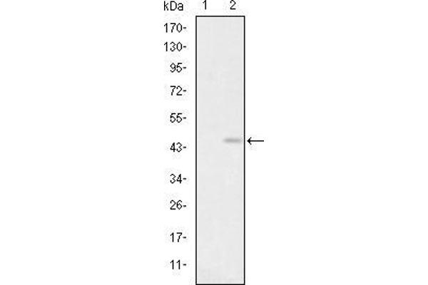 Glutamate Receptor 3 抗体