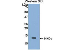 Western Blotting (WB) image for anti-Slit Homolog 2 (Drosophila) (SLIT2) (AA 1408-1519) antibody (ABIN1860578) (SLIT2 抗体  (AA 1408-1519))