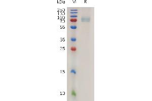 Human CD19 Protein, mFc Tag on SDS-PAGE under reducing condition.