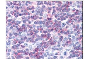 Human Tonsil: Formalin-Fixed, Paraffin-Embedded (FFPE) (IFITM1 抗体  (C-Term))