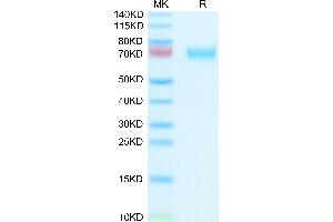 Human HPX on Tris-Bis PAGE under reduced condition. (Hemopexin Protein (HPX) (AA 24-462) (His tag))