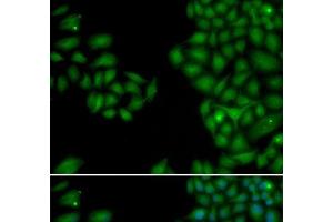 Immunofluorescence analysis of HeLa cells using NEFL Polyclonal Antibody (NEFL 抗体)
