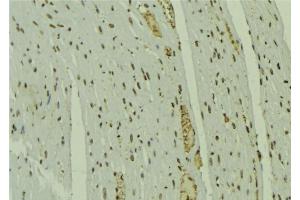 ABIN6279632 at 1/100 staining Mouse muscle tissue by IHC-P. (NOL7 抗体  (C-Term))