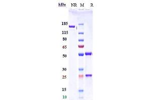 Anti-PDCD1 / PD-1 / CD279 Reference Antibody (serplulimab) on SDS-PAGE under reducing (R) condition. (Recombinant PDCD1 (Serplulimab Biosimilar) 抗体)
