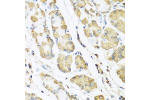 Immunohistochemistry of paraffin-embedded human stomach using MLN antibody (ABIN6128307, ABIN6143890, ABIN6143891 and ABIN6222013) at dilution of 1:100 (40x lens). (Motilin 抗体  (AA 26-115))