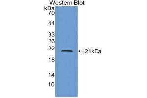 Western blot analysis of the recombinant protein. (CRH 抗体  (AA 40-195))