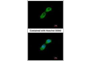 Immunofluorescence (IF) image for anti-Tubulin Folding Cofactor B (TBCB) antibody (ABIN2855232)