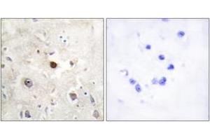 Immunohistochemistry analysis of paraffin-embedded human brain, using p57KIP2 Antibody. (CDKN1C 抗体  (AA 11-60))
