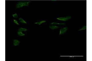 Immunofluorescence of monoclonal antibody to SP1 on HeLa cell. (SP1 抗体  (AA 522-618))