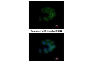 ICC/IF Image Immunofluorescence analysis of methanol-fixed HCT116, using MRCK alpha, antibody at 1:500 dilution. (CDC42BPA 抗体)