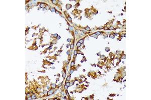Immunohistochemistry of paraffin-embedded mouse testis using  Rabbit mAb (ABIN7265369) at dilution of 1:100 (40x lens).