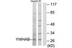 Western blot analysis of extracts from HepG2/Jurkat cells, using 14-3-3 beta Antibody. (YWHAB 抗体  (AA 41-90))