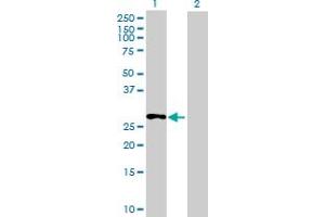Western Blot analysis of C13orf39 expression in transfected 293T cell line ( H00196541-T01 ) by C13orf39 MaxPab polyclonal antibody. (METTL21C 抗体  (AA 1-264))