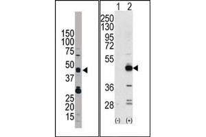 Image no. 1 for anti-Tribbles Homolog 3 (Drosophila) (TRIB3) (N-Term) antibody (ABIN360673) (TRIB3 抗体  (N-Term))