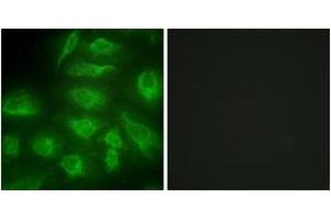 Immunofluorescence analysis of HeLa cells, using DGKI Antibody. (DGKI 抗体  (AA 991-1040))