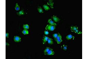Immunofluorescent analysis of MCF-7 cells using ABIN7166144 at dilution of 1:100 and Alexa Fluor 488-congugated AffiniPure Goat Anti-Rabbit IgG(H+L) (SPIRE2 抗体  (AA 79-388))