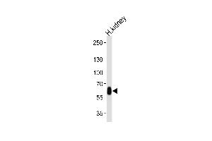 Western blot analysis of lysate from human kidney tissue lysate, using DFNB31 Antibody at 1:1000 at each lane. (DFNB31 抗体  (AA 378-406))
