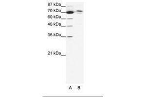 Image no. 1 for anti-Chromosome 14 Open Reading Frame 101 (C14orf101) (AA 249-298) antibody (ABIN6736042) (C14orf101 抗体  (AA 249-298))