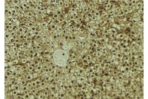 ABIN6273192 at 1/100 staining Mouse liver tissue by IHC-P. (Antizyme Inhibitor 1 抗体  (Internal Region))