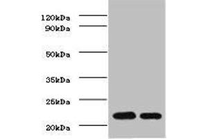 Western BlotPositive WB detected in: mouse heartAll lanes: TIMP1 antibody at 2ug/mlSecondaryGoat polyclonal to rabbit IgG at 1/50000 dilutionPredicted band size: 23 kDaObserved band size: 23 kDa. (TIMP1 抗体  (AA 24-207))