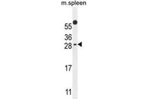 WIBG Antibody (N-term) western blot analysis in mouse spleen tissue lysates (35 µg/lane). (PYM 抗体  (N-Term))