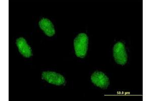 Immunofluorescence of purified MaxPab antibody to MAFG on Daoy cell. (Mafg 抗体  (AA 1-162))