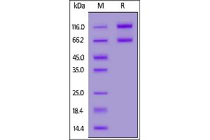 Biotinylated Human IL-2RB&IL-2RA&IL-2RG, Fc,Avitag&Fc,Avitag on  under reducing (R) condition. (IL-2 R beta & IL-2 R alpha & IL-2 R gamma (AA 22-212), (AA 23-254), (AA 27-239) (Active) protein (Fc Tag,AVI tag,Biotin))