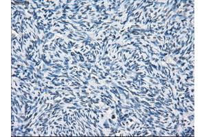 Immunohistochemical staining of paraffin-embedded colon tissue using anti-PSMA7mouse monoclonal antibody. (PSMA7 抗体)