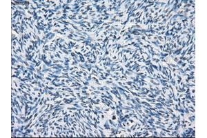 Immunohistochemical staining of paraffin-embedded colon tissue using anti-PSMA7mouse monoclonal antibody. (PSMA7 抗体)