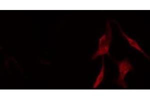 ABIN6276561 staining COLO205 cells by IF/ICC. (BCL2L2 抗体  (N-Term))