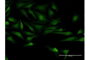 Immunofluorescence of monoclonal antibody to TSGA10 on HeLa cell. (TSGA10 抗体  (AA 599-698))
