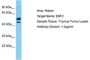 Host: Rabbit Target Name: EBF2 Sample Type: Thymus Tumor lysates Antibody Dilution: 1.