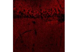 Immunohistochemistry (IHC) image for anti-gamma-aminobutyric Acid (GABA) A Receptor, beta 3 (GABRB3) (AA 344-429) antibody (ABIN1742465)