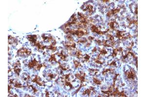 Immunohistochemistry (IHC) image for anti-Mastermind-Like 3 (MAML3) antibody (ABIN6940389)