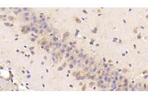 Detection of BNP in Mouse Cerebrum Tissue using Polyclonal Antibody to Brain Natriuretic Peptide (BNP) (BNP 抗体  (AA 77-121))