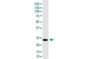 MGC50273 monoclonal antibody (M01), clone 3B10. (MGC50273 (AA 1-209) 抗体)