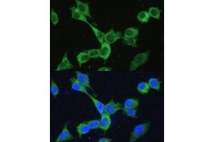 Immunofluorescence (IF) image for anti-Methylenetetrahydrofolate Dehydrogenase (NADP+ Dependent) 2, Methenyltetrahydrofolate Cyclohydrolase (MTHFD2) (AA 40-250) antibody (ABIN6144144)
