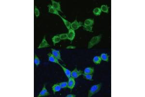 Immunofluorescence analysis of NIH-3T3 cells using MTHFD2 antibody (ABIN6132367, ABIN6144144, ABIN6144145 and ABIN6214625) at dilution of 1:100. (MTHFD2 抗体  (AA 40-250))