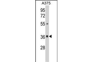 Western blot analysis of GALE Antibody (Center) (ABIN390889 and ABIN2841099) in  cell line lysates (35 μg/lane). (GALE 抗体  (AA 142-171))