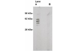 Image no. 1 for anti-Sphingomyelin Synthase 2 (SGMS2) antibody (ABIN265116) (Sphingomyelin Synthase 2 抗体)
