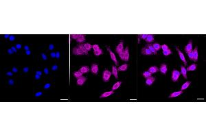 anti-Ferritin Heavy Chain 1 (FTH1) antibody