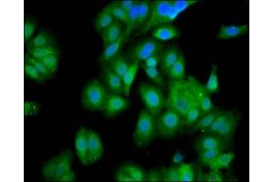 Immunofluorescence staining of HepG2 cells with ABIN7154041 at 1:100, counter-stained with DAPI. (PET112L 抗体  (AA 301-383))