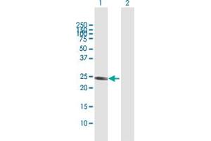 Western Blot analysis of GSTA1 expression in transfected 293T cell line by GSTA1 MaxPab polyclonal antibody. (GSTA1 抗体  (AA 1-222))