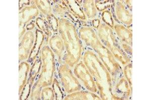 Immunohistochemistry of paraffin-embedded human kidney tissue using ABIN7144749 at dilution of 1:100 (DARS2 抗体  (AA 489-628))