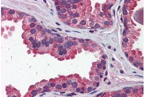 Immunohistochemistry (Formalin-fixed Paraffin-embedded Sections) (IHC (fp)) image for anti-Wingless-Type MMTV Integration Site Family, Member 3A (WNT3A) (N-Term) antibody (ABIN6747185)