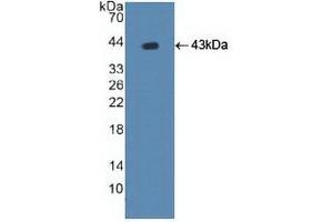 Figure. (ATP7B 抗体  (AA 59-426))