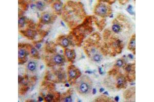 Used in DAB staining on fromalin fixed paraffin-embedded Liver tissue (Orosomucoid 2 抗体  (AA 19-207))